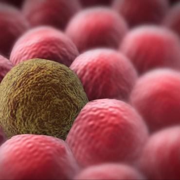 celule_canceroase.jpg